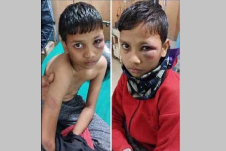 प्रधानध्यापकद्वारा बालकमाथि निर्घात कुटपिट