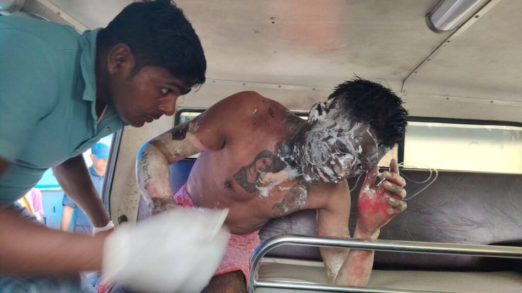रूबी हत्या प्रकरण: जलेका मुख्य आरोपीलाई उपचारका लागि किर्तिपुर पठाईयो